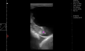 Jak rozpoznać ciążę u konia: objawy i metody diagnozowania