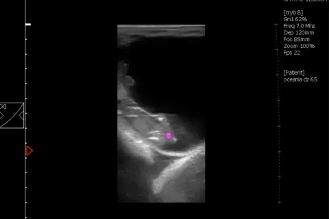 Jak rozpoznać ciążę u konia: objawy i metody diagnozowania