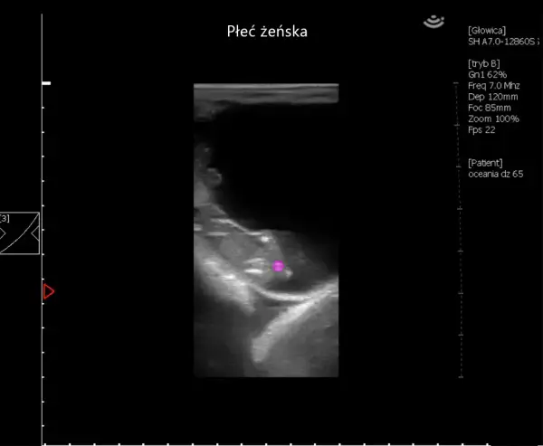 Jak rozpoznać ciążę u konia: objawy i metody diagnozowania